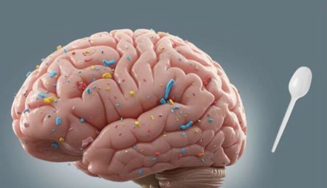 Los cerebros humanos contienen «una cucharada» de microplásticos que dañan la salud mental