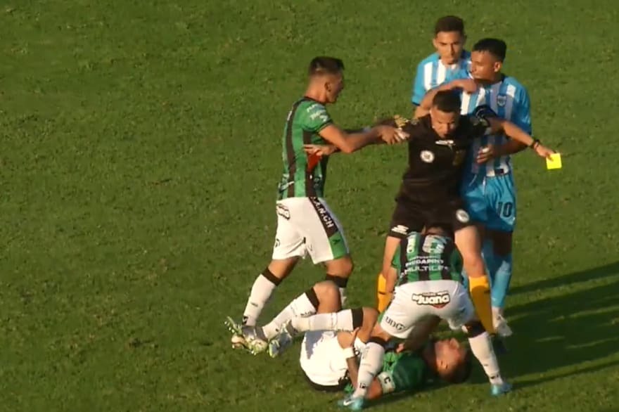 Futbolista recibió una brutal patada y sufrió gravísima lesión que le dejó el pie colgando (VIDEO)